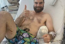 ‘They had to take the knee off’: Quick thinking and luck saved Thomas Orr’s life – but not his leg