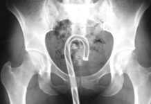 What Did We Get Stuck In Our Rectums Last Year?